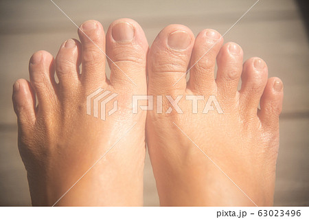 Women's second toes, middle toe, fourth toe crooked, In wooden background, Close up & Macro shot, Selective focus, Asian Body skin part, Healthcare concept Women's second toes, middle toe, fourth toe crooked, In wooden background, Close up & Macro shot, Selective focus, Asian Body skin part, Healthcare concept 63023496