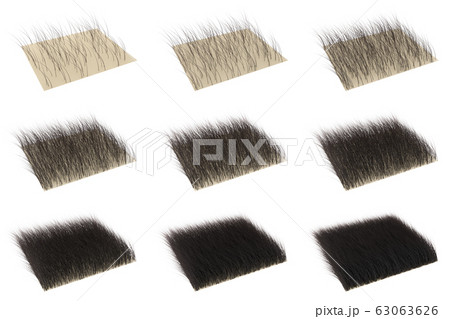 3dレンダリングによる髪の毛が増える段階のイラストセットのイラスト素材