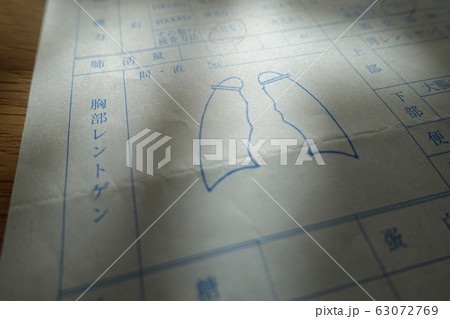 肺の検査結果イメージ　肺炎　肺がん　COPD 63072769
