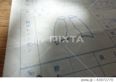 肺の検査結果イメージ　肺炎　肺がん　COPD 63072770
