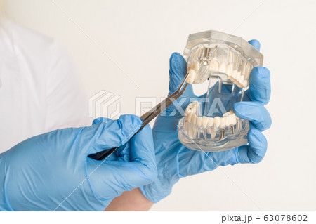 Dentist demonstrates problems with teeth on the Dentist demonstrates problems with teeth on the 63078602
