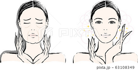 女性　たるみ　ビフォーアフター 63108349