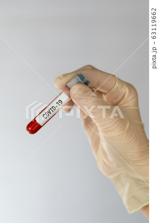 Laboratory sample of blood testing for diagnosis new Corona virus infection COVID-19 from Wuhan, China. Pandemic infectious concept. Laboratory sample of blood testing for diagnosis new Corona virus infection COVID-19 from Wuhan, China. Pandemic infectious concept. 63119662