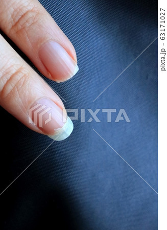爪割れ 63171027
