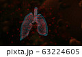 Human lungs infected by the Coronavirus. Human lungs infected by the Coronavirus. Illustration 63224605