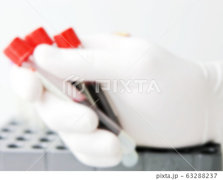 2019-nCoV laboratory testing for suspected human 63288237