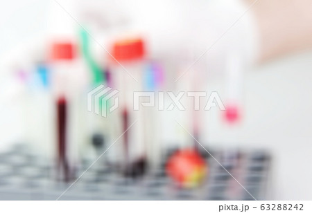 2019-nCoV laboratory testing for suspected human 2019-nCoV laboratory testing for suspected human 63288242