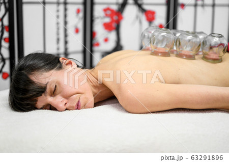 Traditional Chinese Medicine therapy. Cupping therapy, a treatment used for pain relief and other Traditional Chinese Medicine therapy. Cupping therapy, a treatment used for pain relief and other 63291896