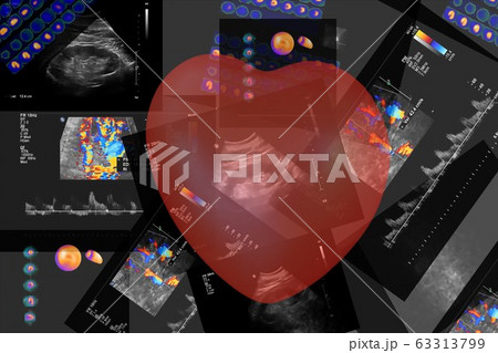 Coronary computed tomography angiography (CCTA) of the heart and coronary vessels using contrast fluid and stress and determine whether they have been narrowed. Set of result Coronary computed tomography angiography (CCTA) of the heart and coronary vessels using contrast fluid and stress and determine whether they have been narrowed. Set of result 63313799