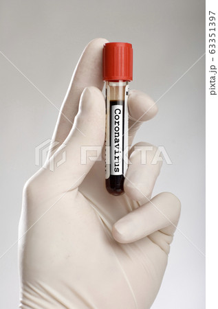 Coronavirus 63351397