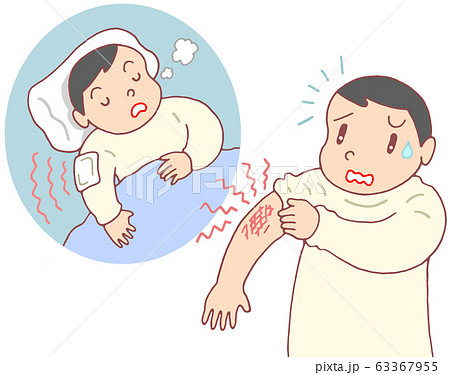 低温やけどのイラスト素材