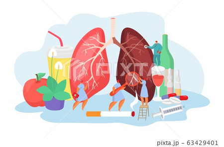 Lungs desease with doctors medical concept of pneumania illness diagnosis and treatment vector illustration. 63429401