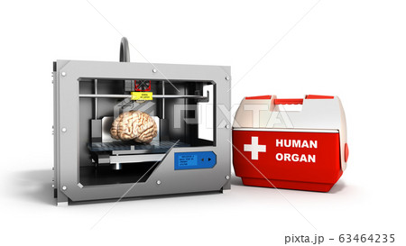 concept of transplantation process of creating 63464235