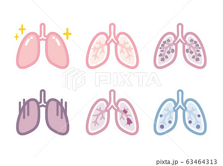 Lung disease illustration Lung disease illustration 63464313