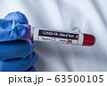 blood sample ampoule coronavirus, covid-19, positive test result 63500105