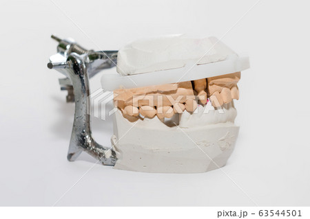 Plaster Cast of jaws. Dental casting gypsum model Plaster Cast of jaws. Dental casting gypsum model 63544501