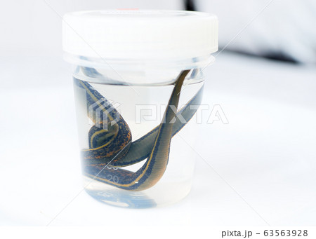 Hirudotherapy. medical leeches in a glass in water Hirudotherapy. medical leeches in a glass in water 63563928