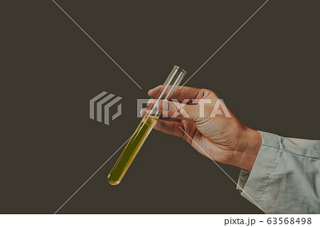 黄色い液体の検査 尿検査 黄色い液体の検査 尿検査 63568498