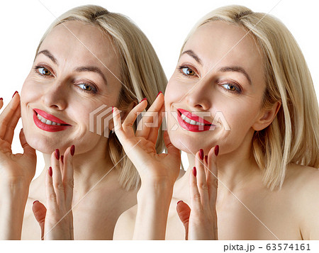Adult sensual woman before and after skin retouch or treatment. Adult sensual woman before and after skin retouch or treatment. 63574161