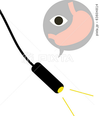 胃カメラ 検査 胃カメラ 検査 63604814