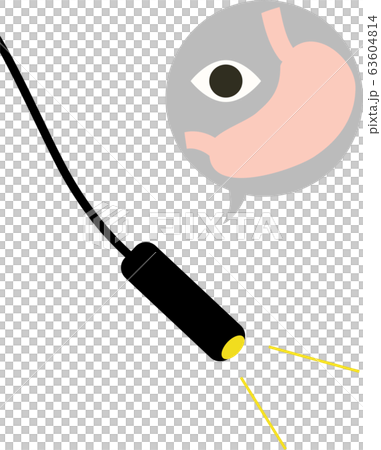 胃カメラ 検査 胃カメラ 検査 63604814