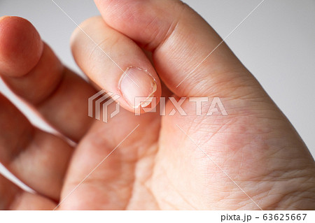 二枚爪 63625667