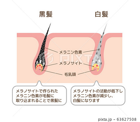 黒髪と白髪　発生の仕組み・メカニズム比較　皮膚断面図イラスト 63627508