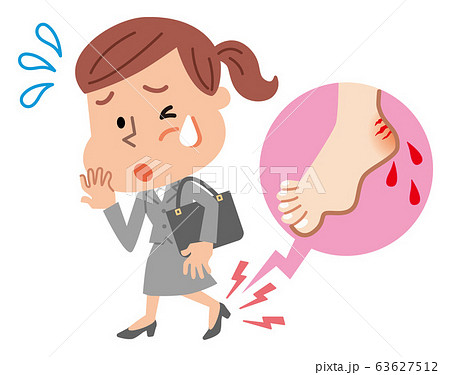 靴擦れ　女性　イラスト 63627512