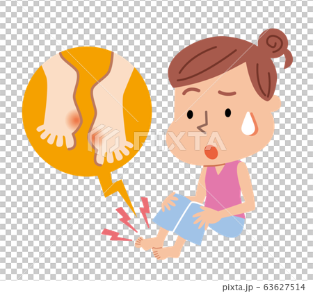Hallux valgus woman illustration 63627514