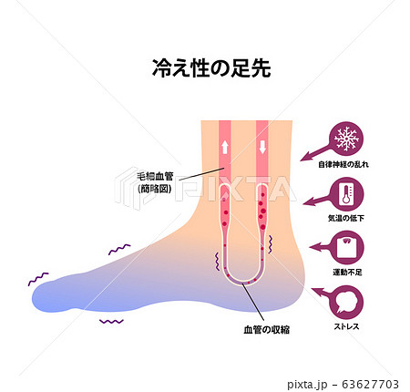 末端冷え性の足 イラスト 冷え性の原因 のイラスト素材