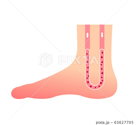 通常の足 イラスト (冷え性の原因) / 文字なし 63627705