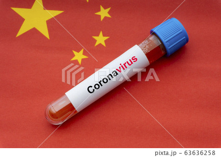 CORONAVIRUS text and blood sample vacuum tube on 63636258