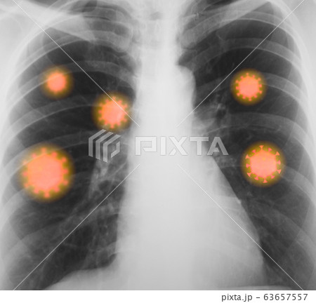 Image photo Image photo 63657557