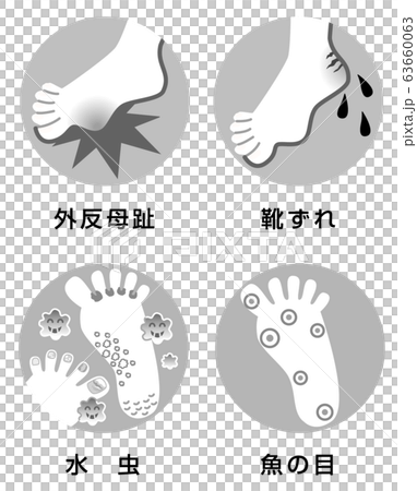 足のトラブル　４症例　　モノクロ　イラスト 63660063