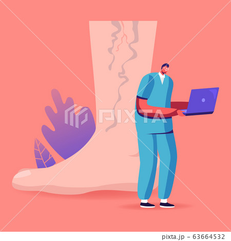 Feet Health Care, Podiatry Concept. Tiny Doctor Character Working on Laptop at Huge Foot with Diseased Spider Veins 63664532
