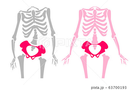 骨盤の歪みのイラストのイラスト素材
