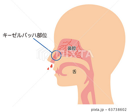 キーゼルバッハ部位　鼻血　構造 63738602