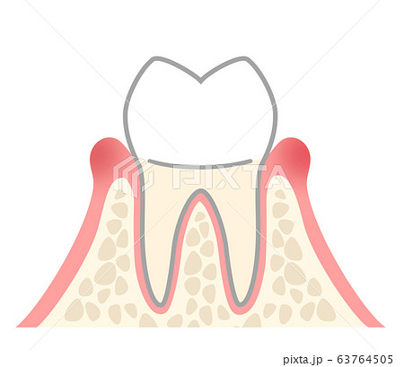 歯 歯肉炎のイラスト素材