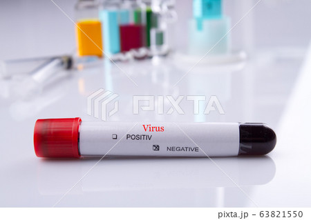 Close up coronavirus blood test in a tube with negative result. Close up coronavirus blood test in a tube with negative result. 63821550