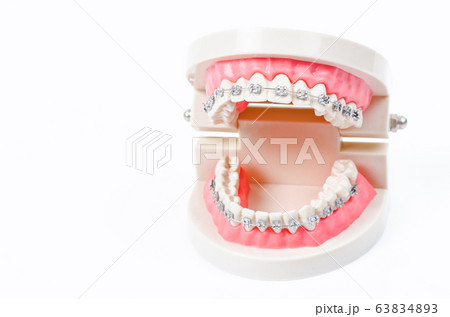 tooth model with metal wire dental braces. tooth model with metal wire dental braces. 63834893
