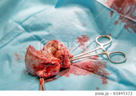 removal of benign tumor on the dog's paw by surgery 63845372