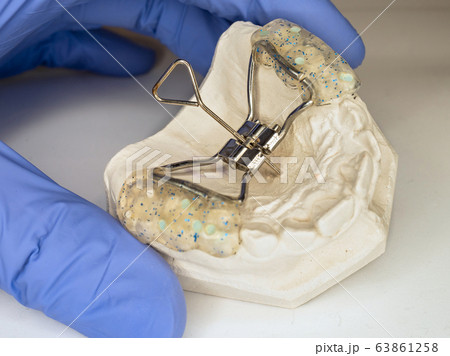 Children braces. Test Hyrax rapid palatal expander 63861258