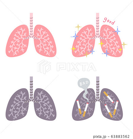 肺のイラスト アイコン4種類 健康な肺 きれいな肺 汚れた肺 喫煙者の肺 のイラスト素材