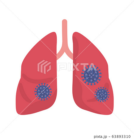 ウイルス感染をしている肺 イラスト ウイルス感染をしている肺 イラスト 63893310