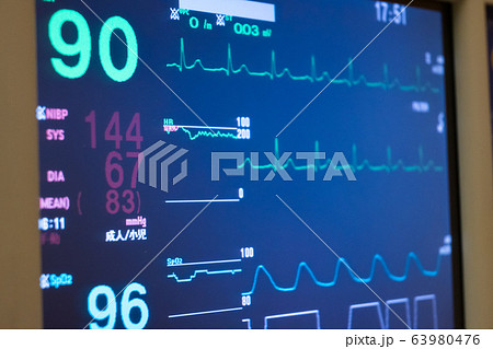 心電図モニター 肺炎の写真素材