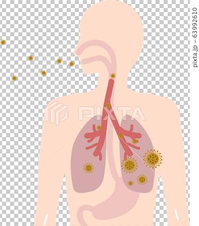 Image of absorbing and coughing virus 63992610