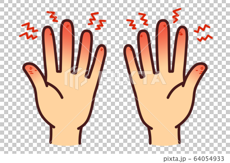 手荒れ　イラスト 64054933