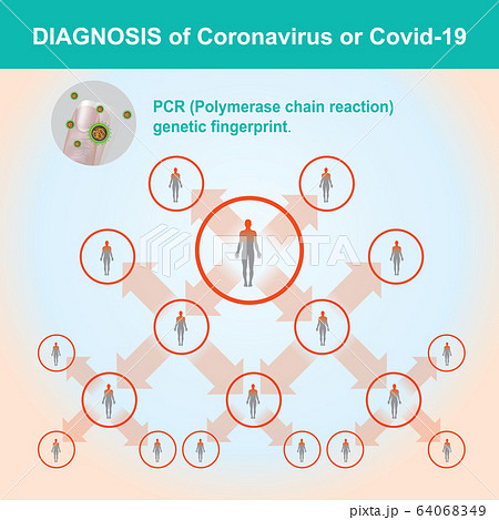 Diagnosis of Coronavirus or COVID-19. Illustrationのイラスト素材 [64068349 ...