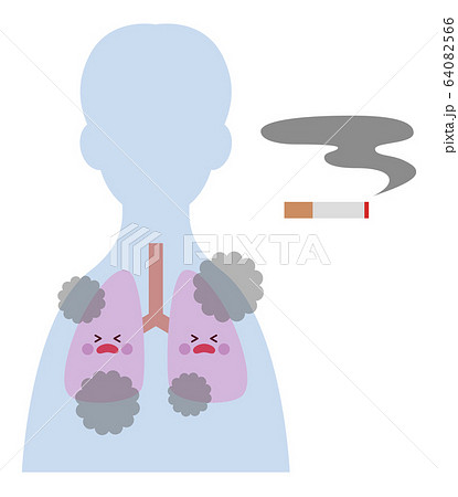 喫煙者（男性）の肺 64082566