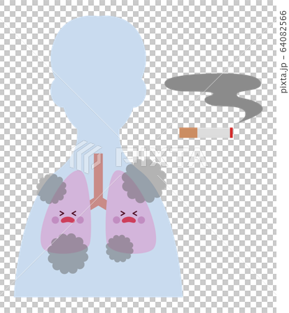 喫煙者（男性）の肺 64082566